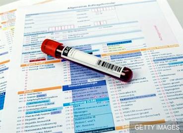 Analisis de sangre